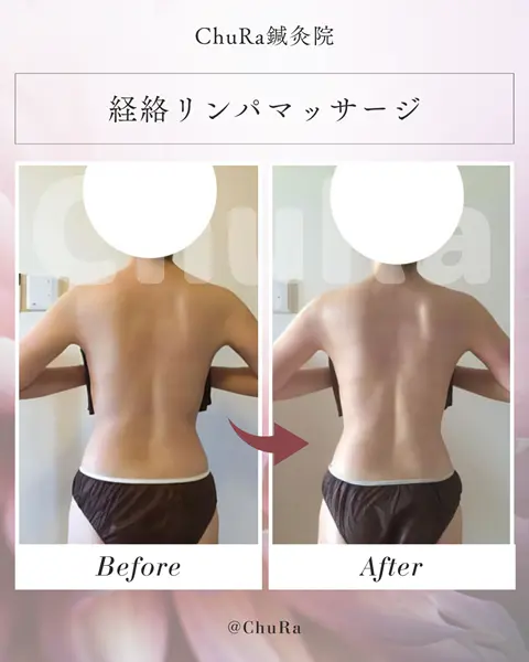 ビフォーアフター