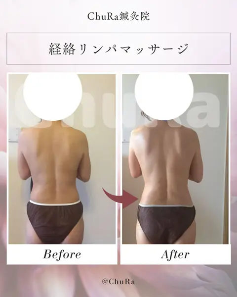 ビフォーアフター