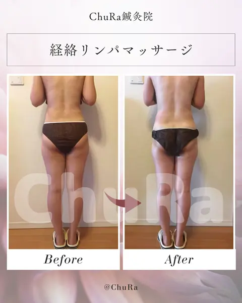 ビフォーアフター