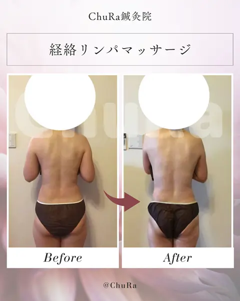 ビフォーアフター